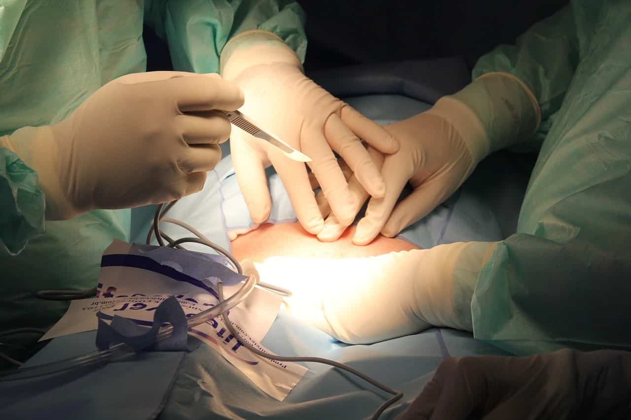Causes Surgical Stapler Injury?